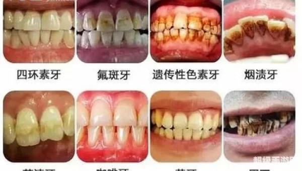 一口健康的牙齿是什么颜色